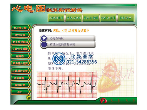 心电图教学考核软件