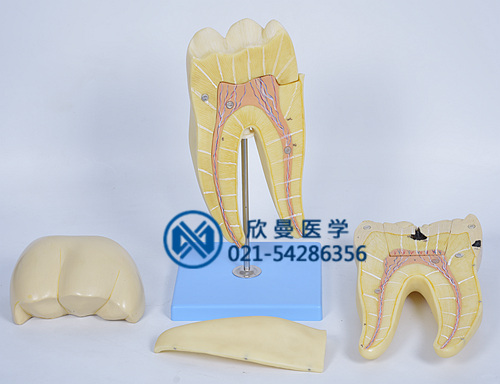 磨牙蛀牙解剖放大模型分解为2部件结构