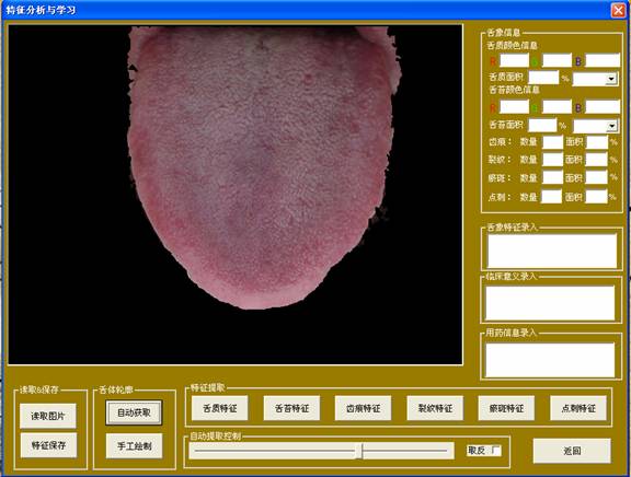 中医舌诊仪分析与学习界面