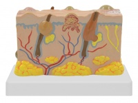 皮肤病变模型