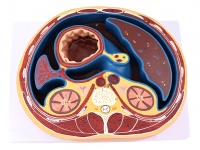 腹腔横断模型